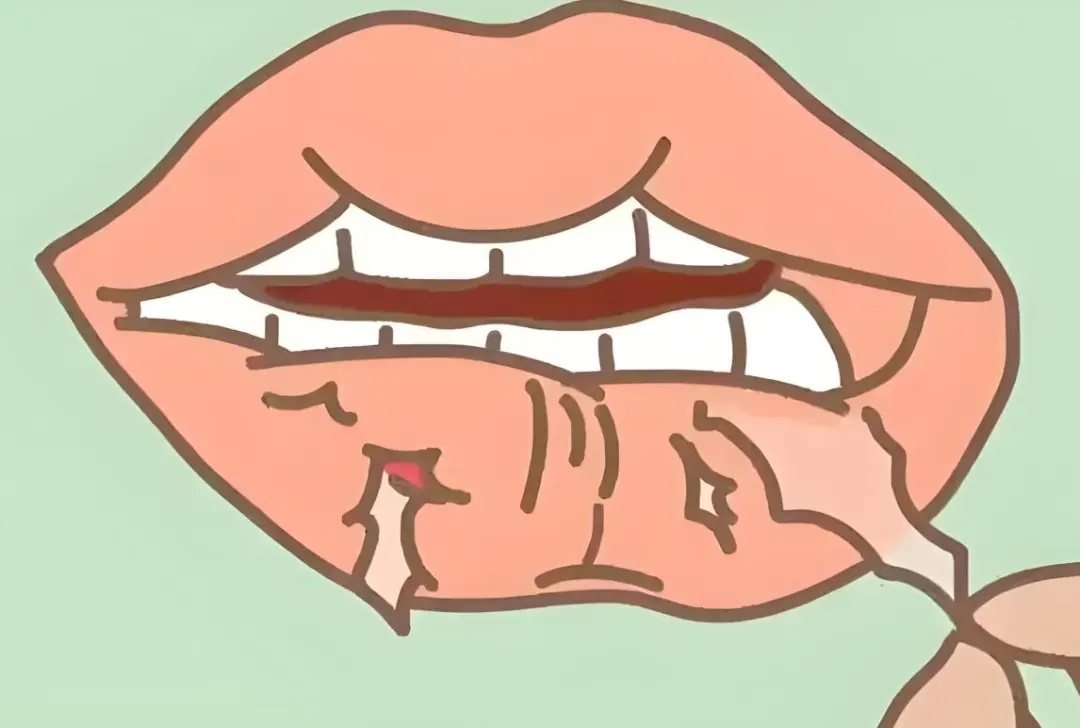 嘴唇干裂起皮?别只怪缺水!这5个隐藏原因才是关键